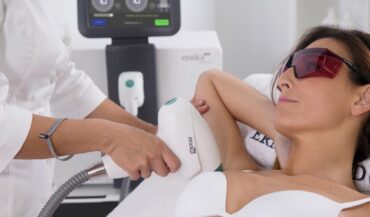 Four Tips for Laser Hair Removal